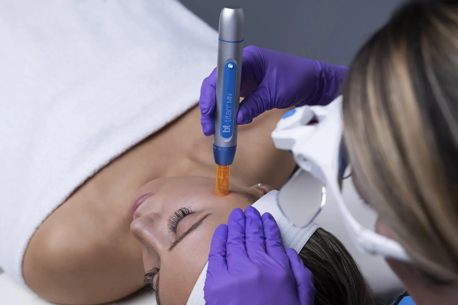 MicroNeedling-Behandlung im Studio